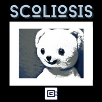 Scoliosis_CG5