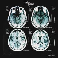 X-Ray_Nate Good