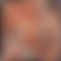 Genital Grinder_Carcass