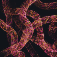 Spiral Dreams_Coroner