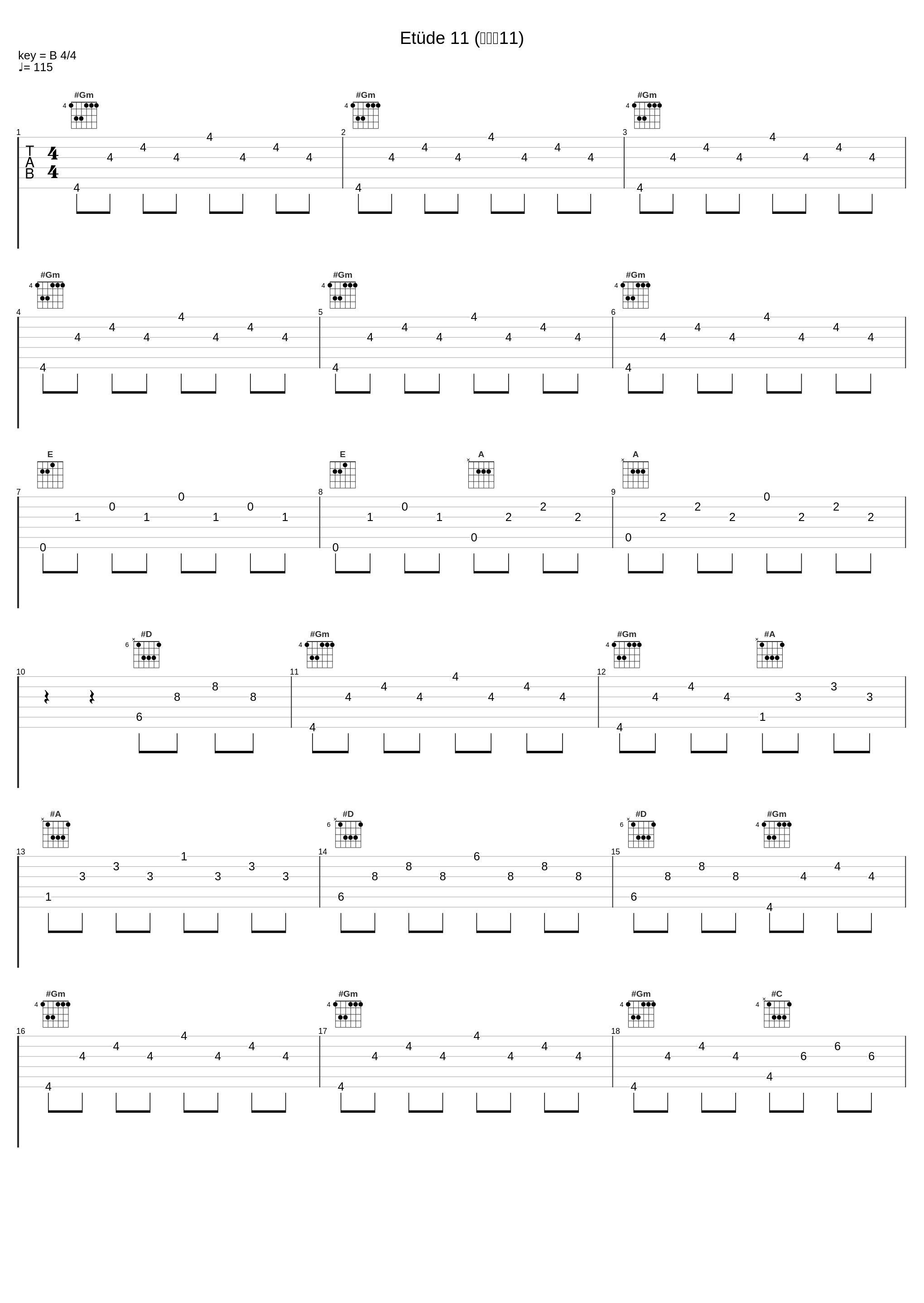 Etüde 11 (练习曲11)_Jörg Demus,Robert Schumann_1