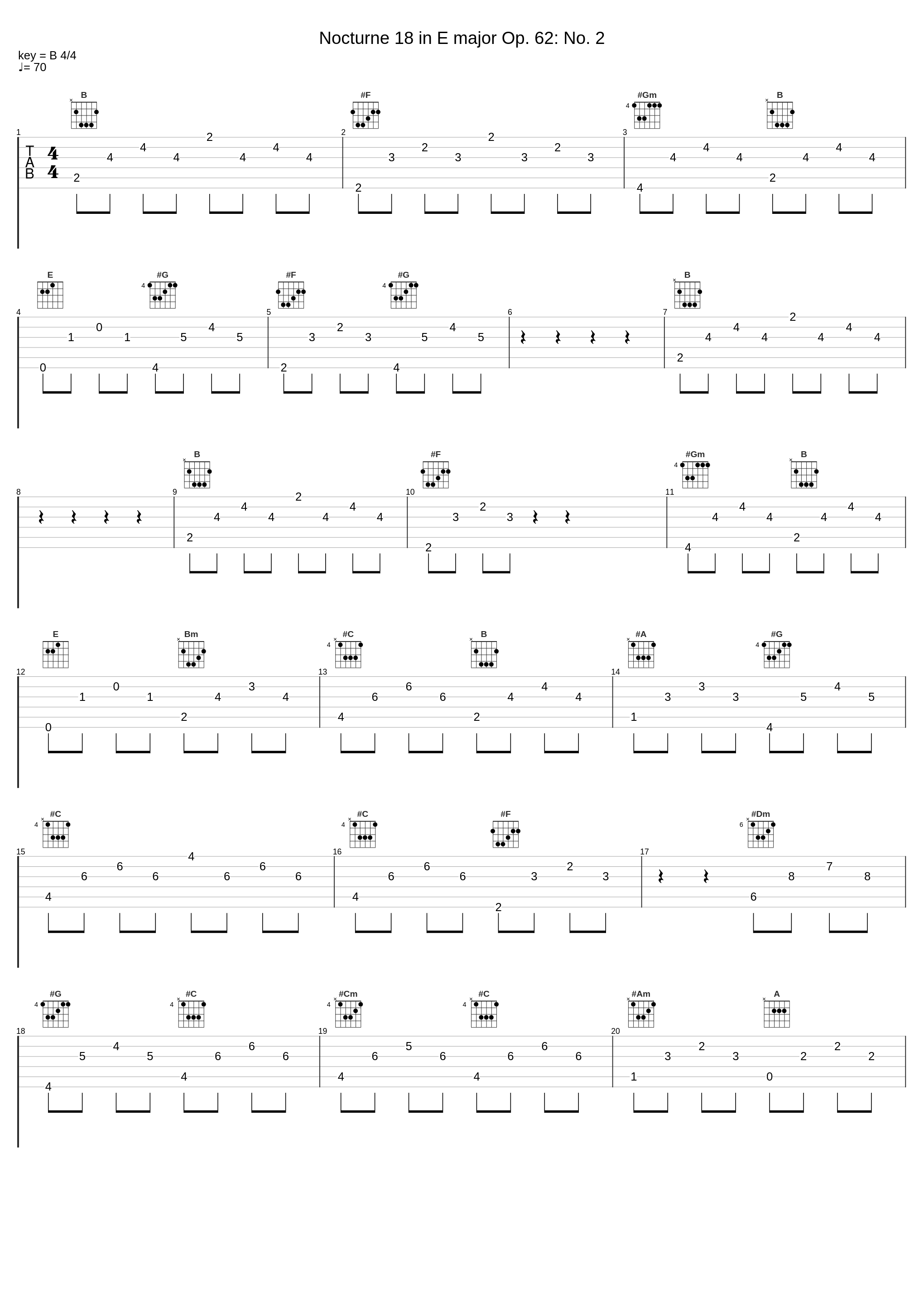 Nocturne 18 in E major Op. 62: No. 2_The Synthesizer,Frédéric Chopin_1