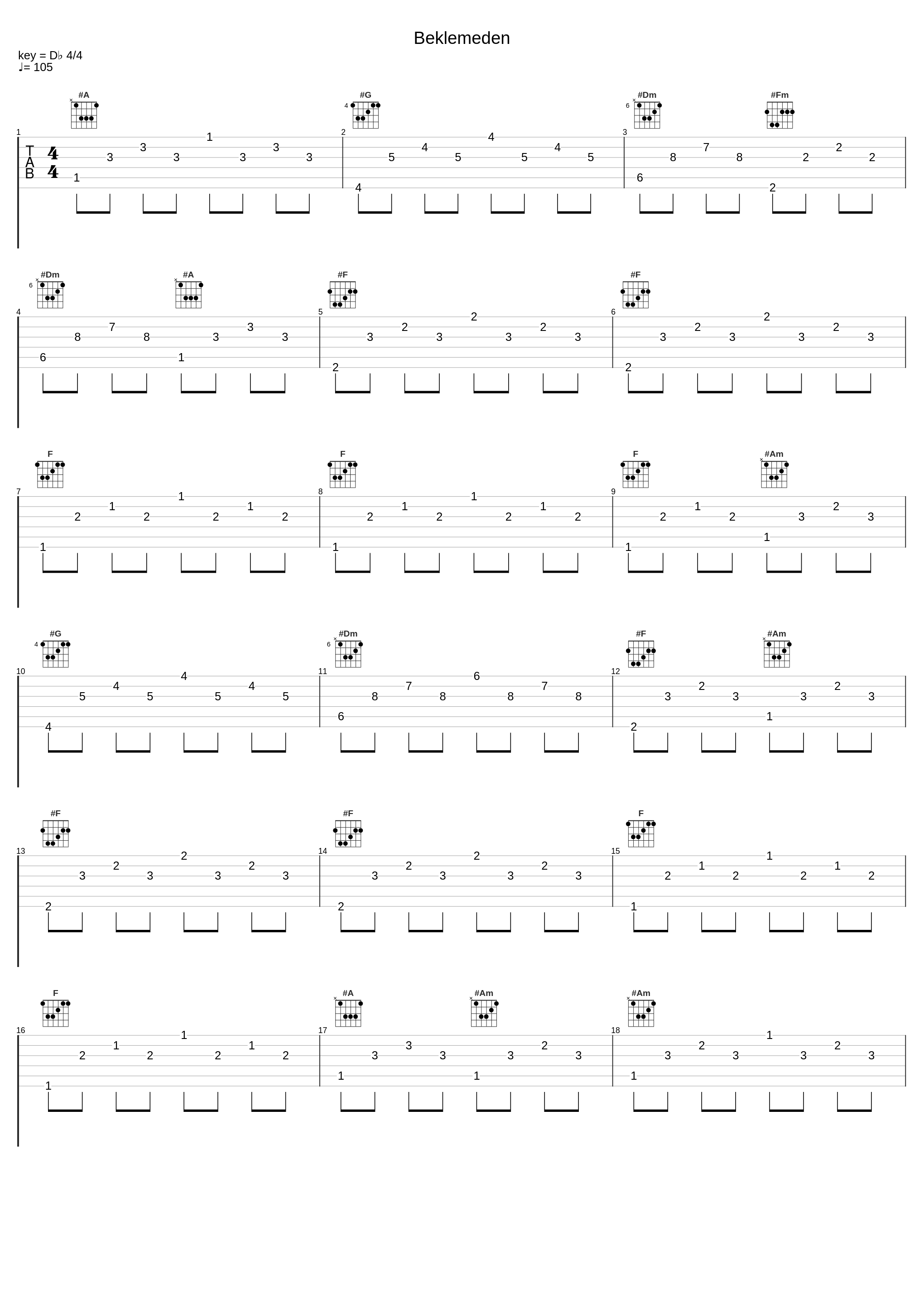 Beklemeden_Candan Erçetin_1