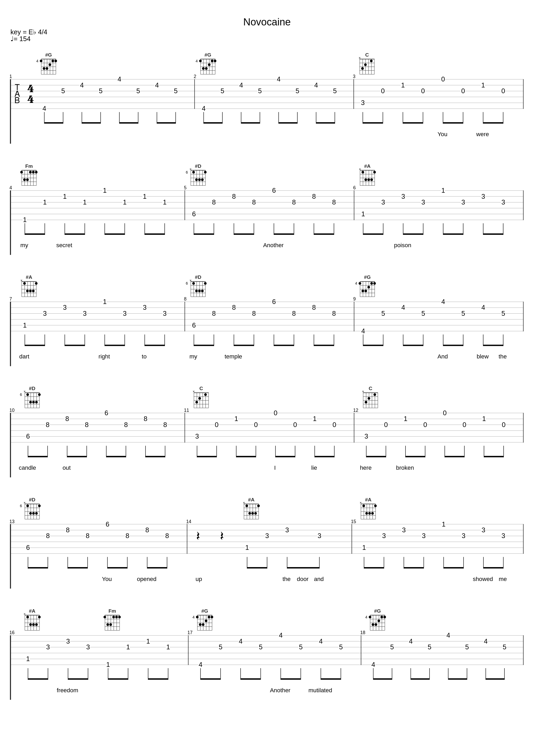 Novocaine_Twin Atlantic_1