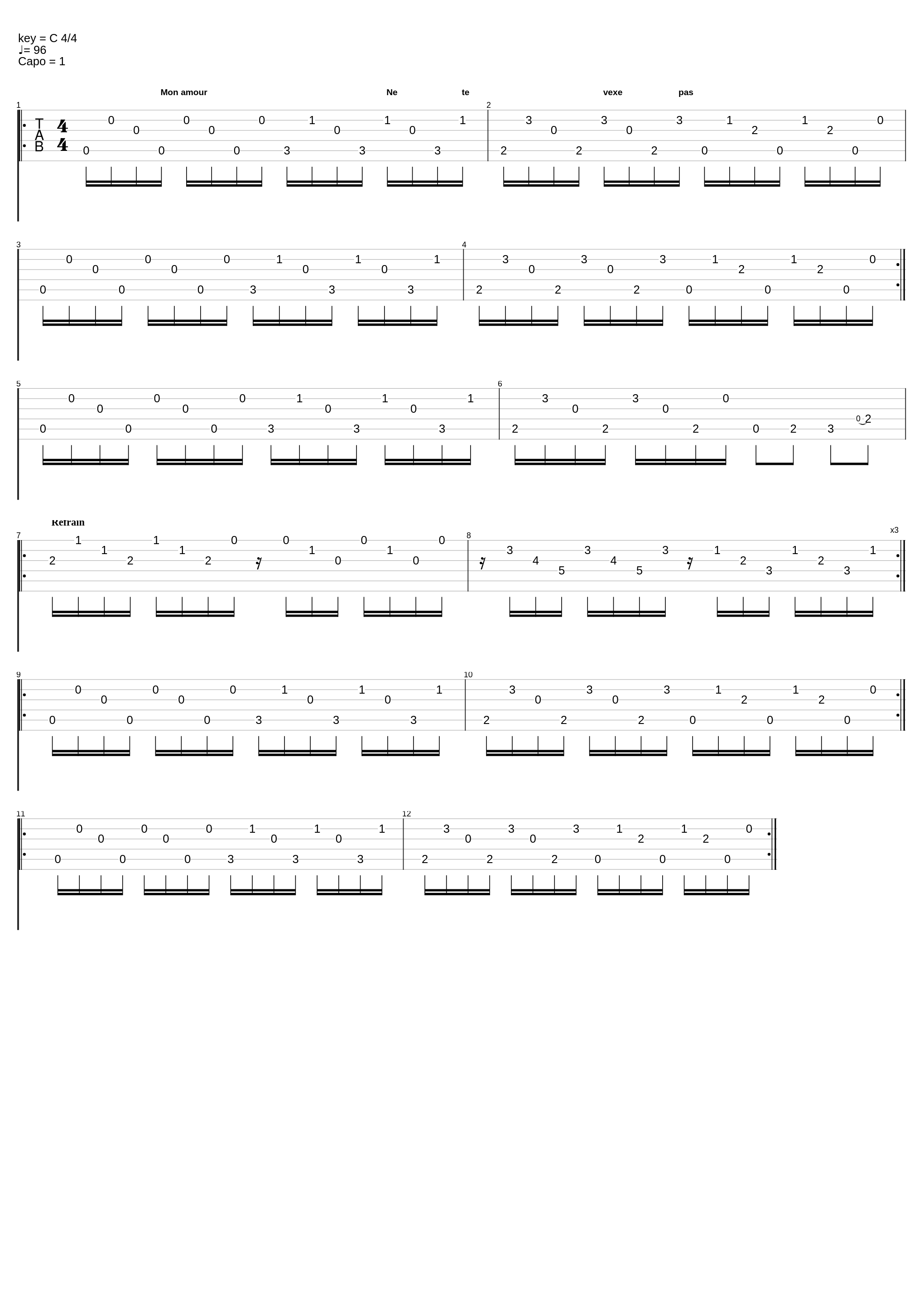 Mon Coeur Ne Bat Plus_Gerald De Palmas_1