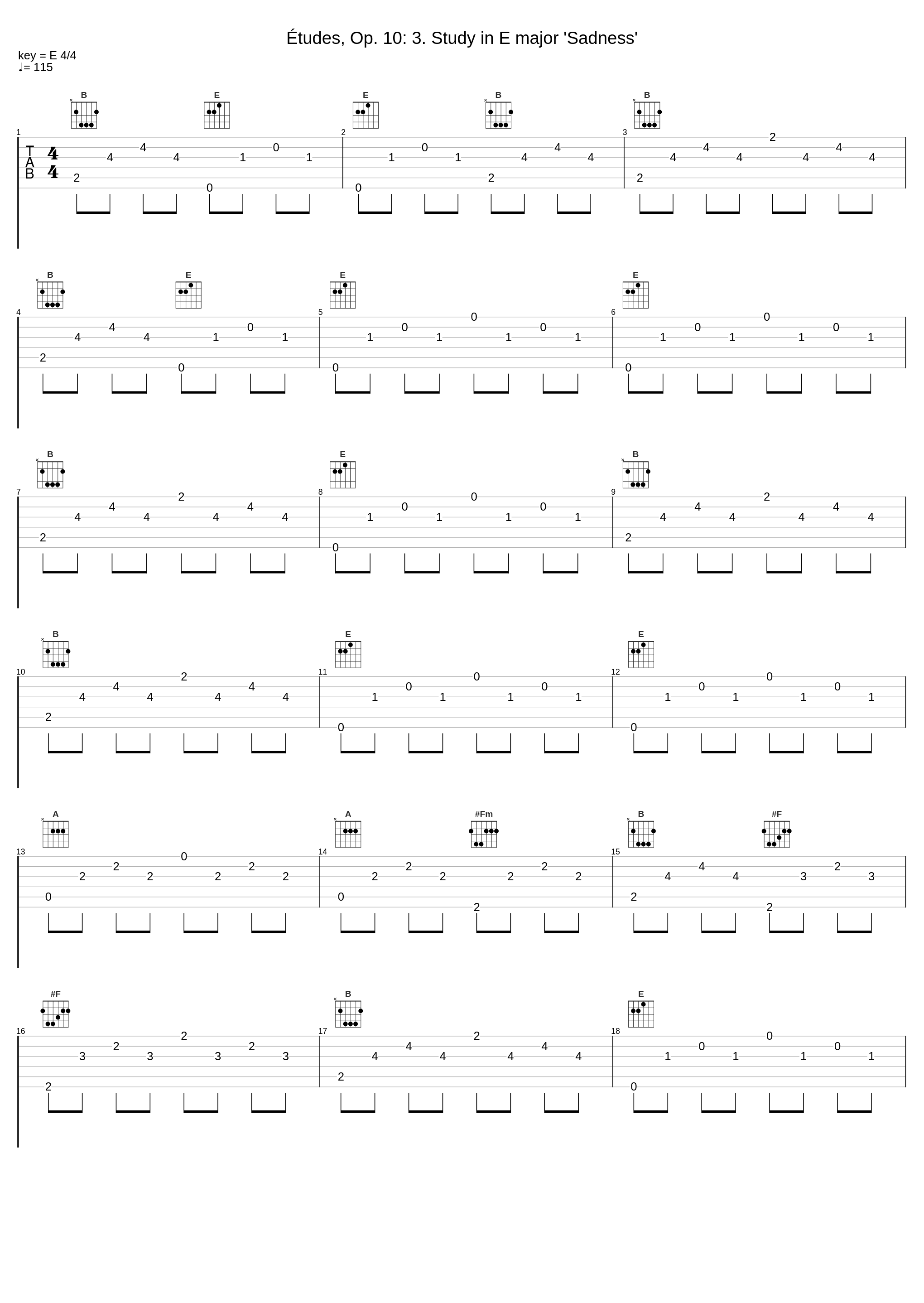 Études, Op. 10: 3. Study in E major 'Sadness'_Beautiful Pianists,Frédéric Chopin_1