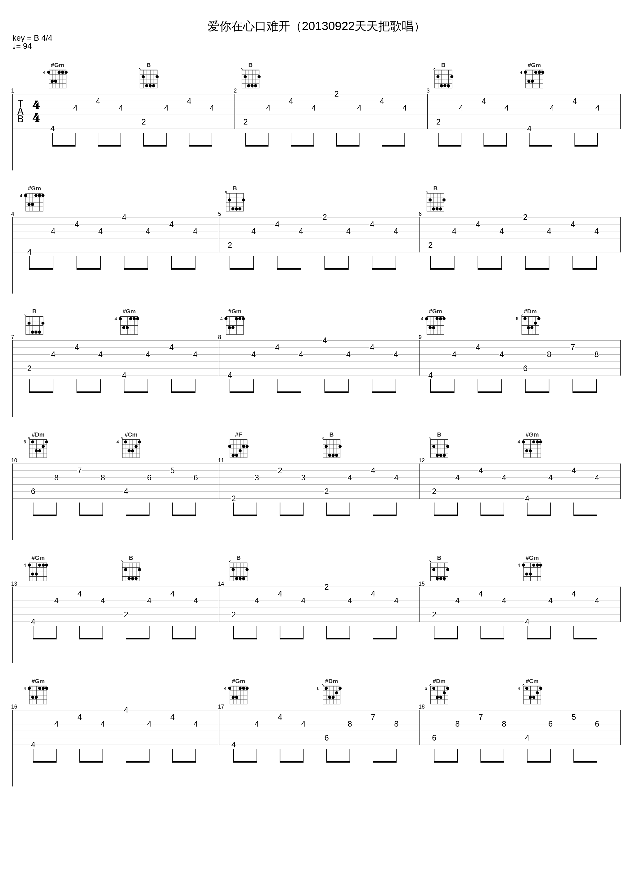 爱你在心口难开（20130922天天把歌唱）_阿宝_1