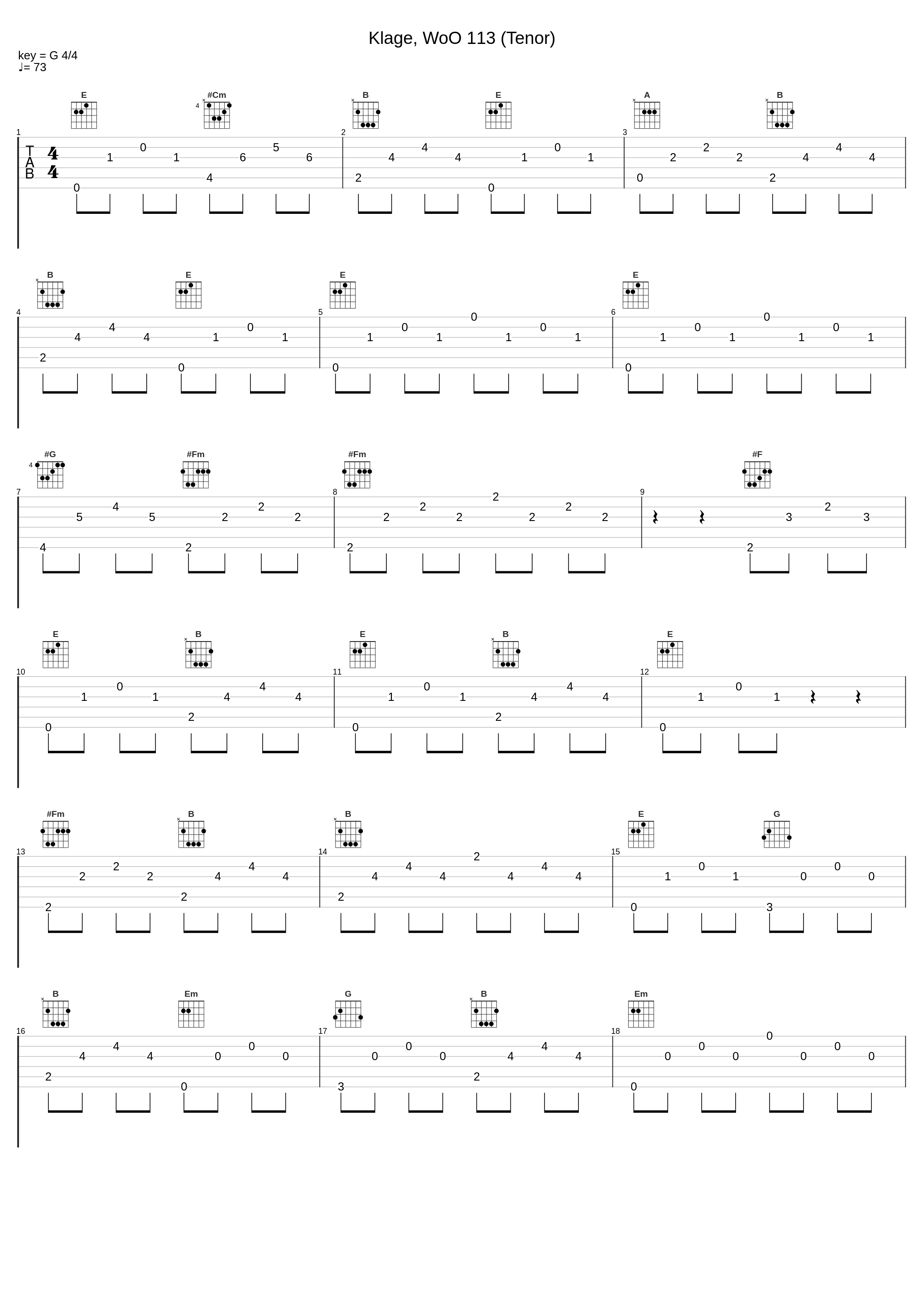 Klage, WoO 113 (Tenor)_Peter Schreier,Walter Olbertz_1