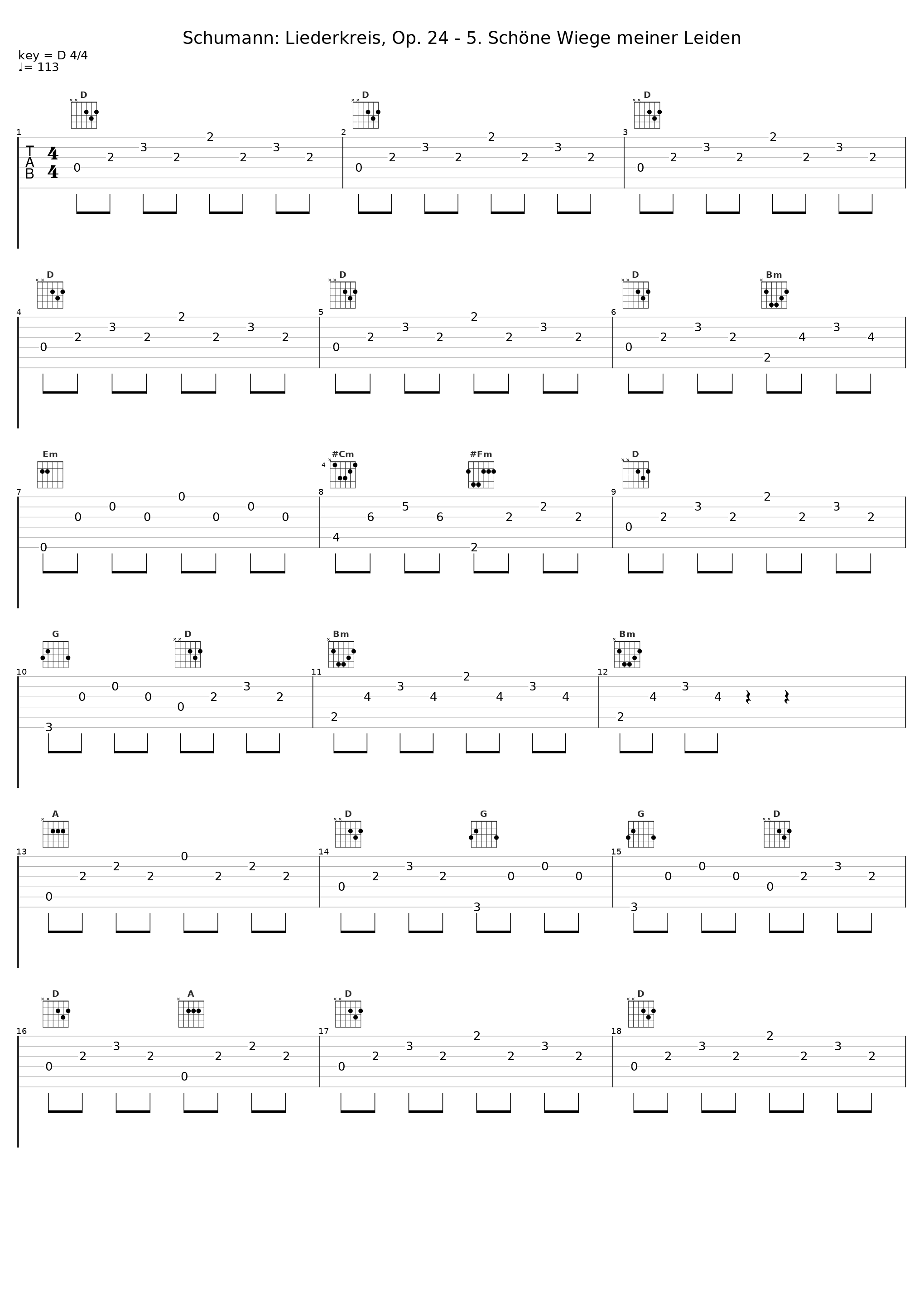 Schumann: Liederkreis, Op. 24 - 5. Schöne Wiege meiner Leiden_Brigitte Fassbaender,Irwin Gage_1