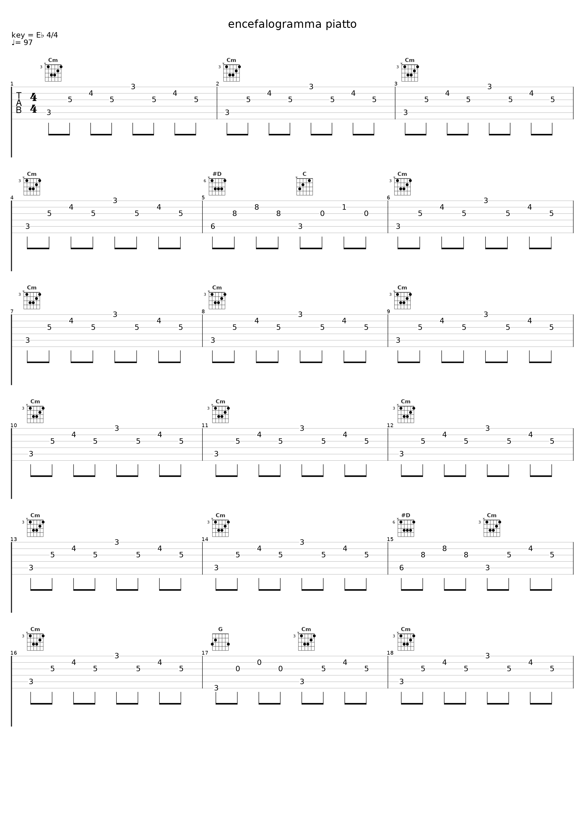 encefalogramma piatto_Gugi_1