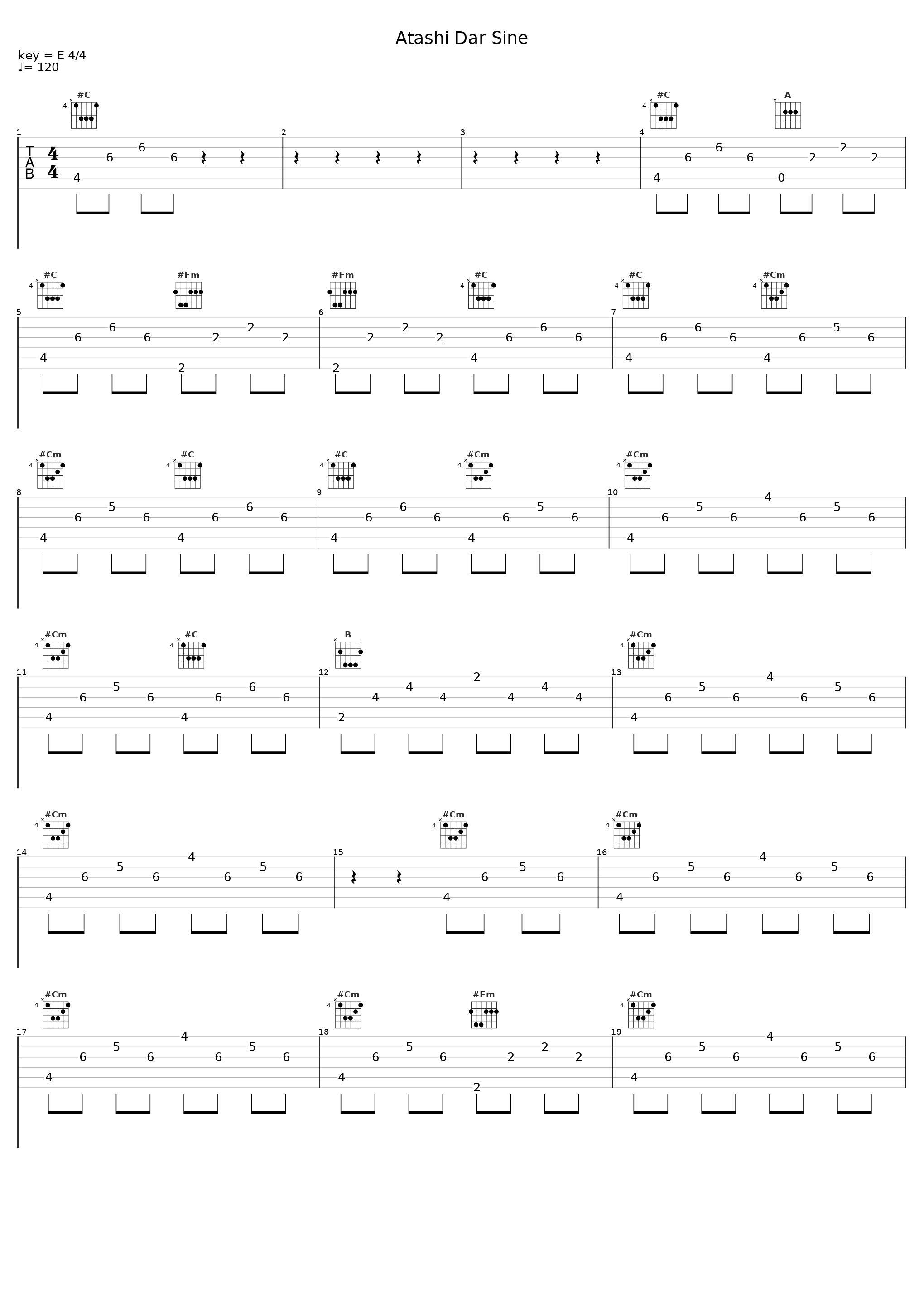 Atashi Dar Sine_Reza Bahram_1