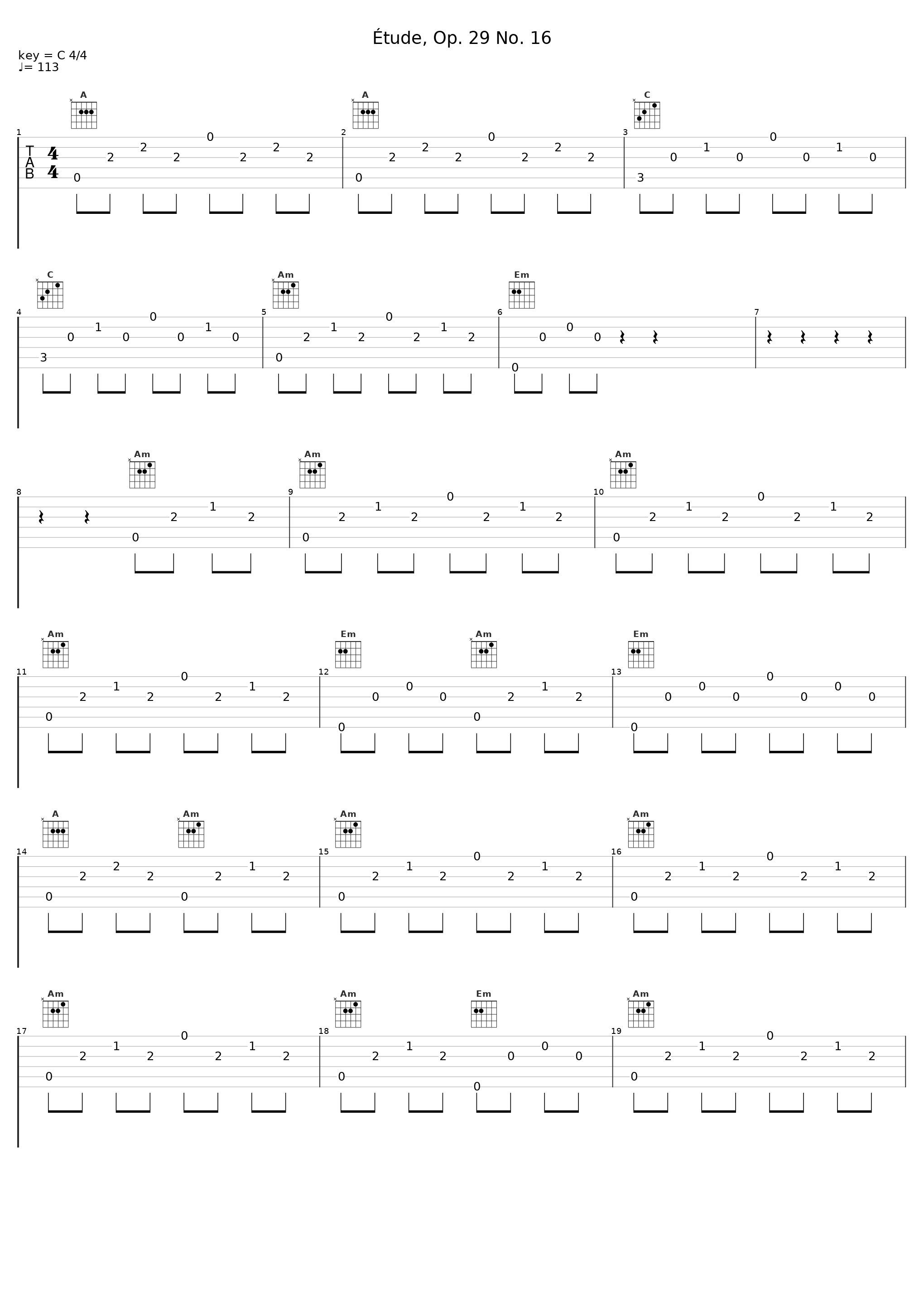 Étude, Op. 29 No. 16_Philippe Mouratoglou_1