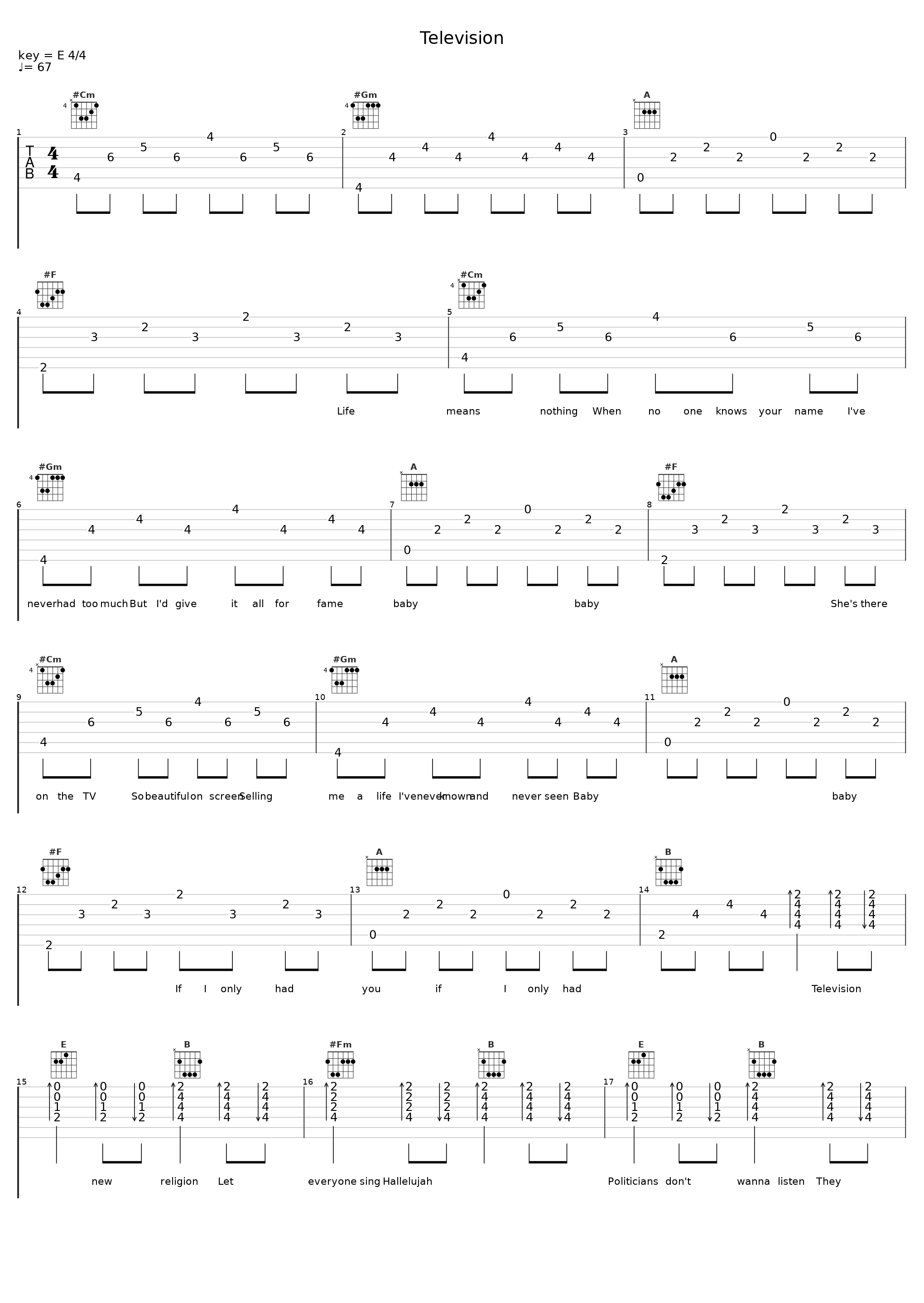 Television_Hard-Fi_1