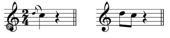 Long Appoggiatura|SheetMusicGo