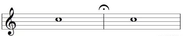 Fermata|SheetMusicGo