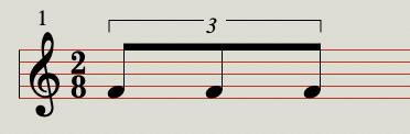 Triplets|SheetMusicGo