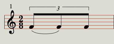 Triplet Tie|SheetMusicGo