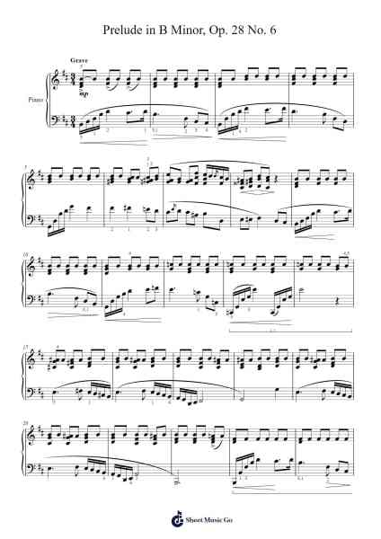 Prelude in B Minor, Op. 28, No. 6 Sheet Music by Frederic Chopin-Arr.Kepmill Rexbloor