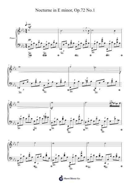 Nocturne in E Minor, Op. 72 No. 1 Sheet Music by Frédéric Chopin-Arr.Virquinn Hoodvid